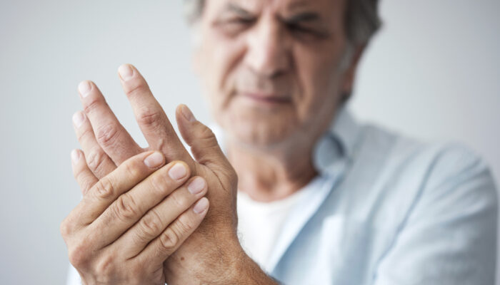 7 Early Signs of Psoriatic Arthritis