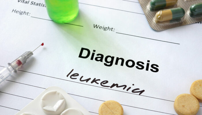 Acute Myeloid Leukemia &#8211; Stages, Types, Symptoms, Causes, and Therapies