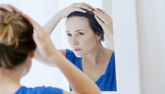 Best Vitamins for Preventing Hair Loss