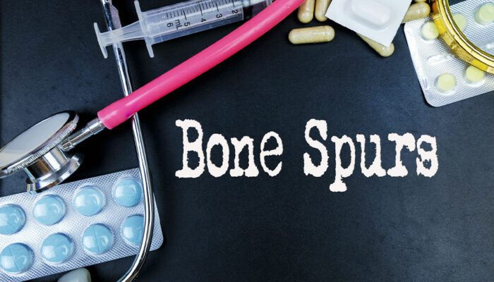 Bone Spurs &#8211; Causes, Types, and Management Options