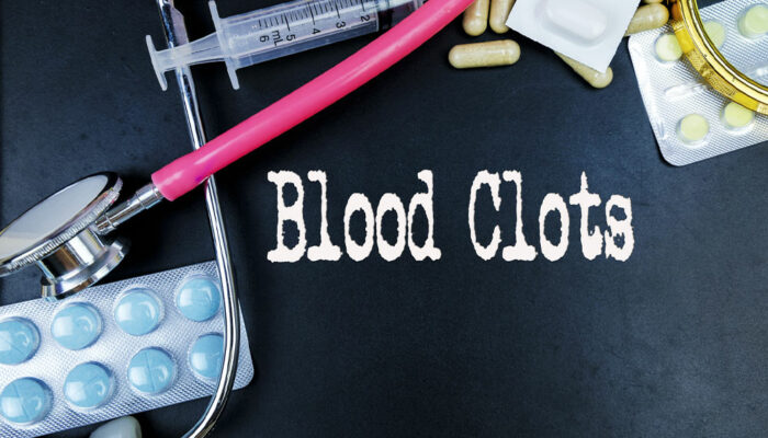 Blood Clotting Disorders &#8211; Symptoms, Causes, and More