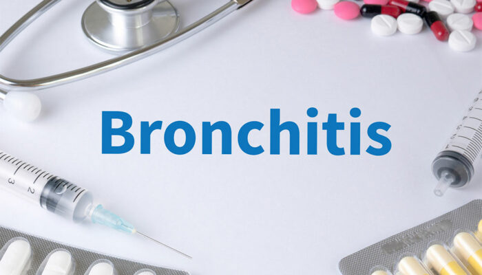 Bronchitis &#8211; Top Remedies and Management Options