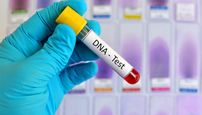 DNA Testing &#8211; Definition, Types, and Procedure