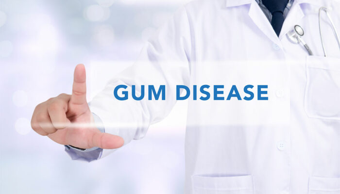 Gum Disease &#8211; Symptoms and Remedies