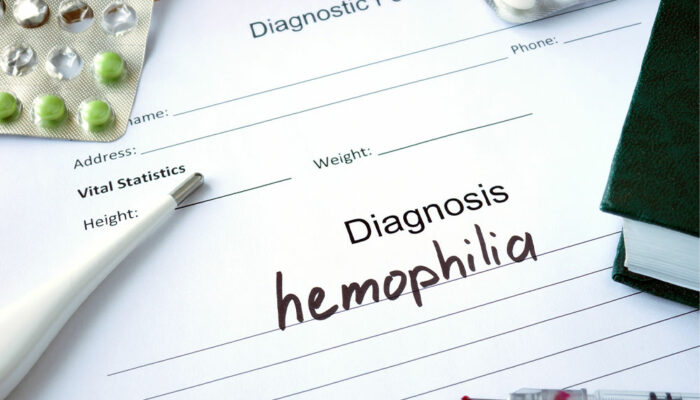 Hemophilia &#8211; Symptoms, Types, and Management Options