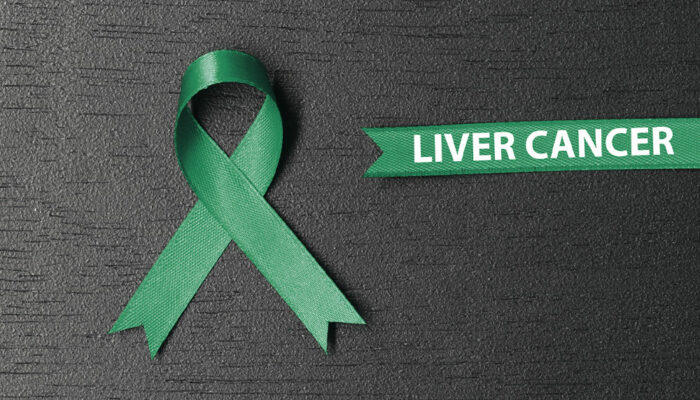 Liver Cancer &#8211; Causes, Symptoms, and Therapies