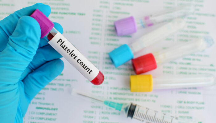 Low Platelet Count &#8211; Ways to Manage the Condition