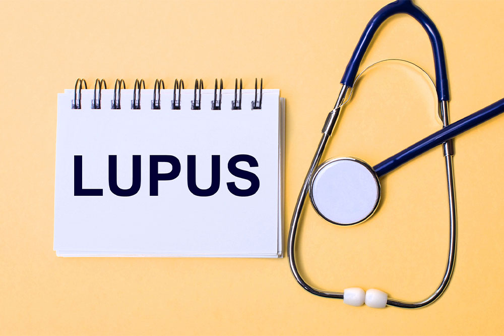 Lupus &#8211; Signs, Causes and Types