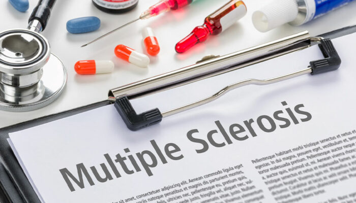 Multiple Sclerosis &#8211; Types, Diagnosis and Management Options