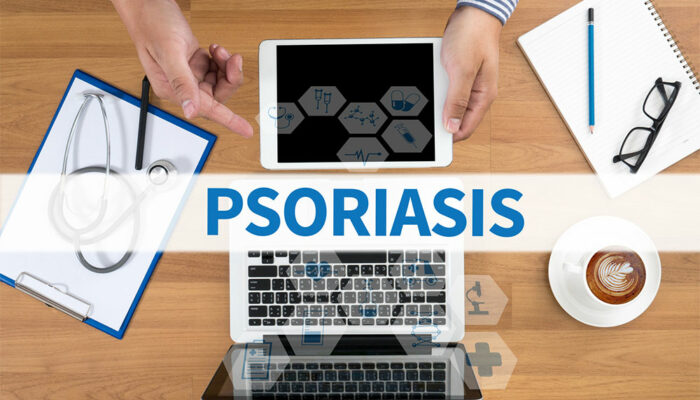 Psoriasis &#8211; Its Types and Symptoms