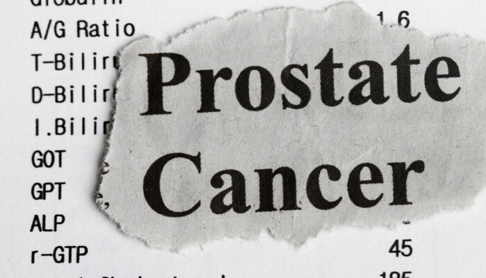 Stages, and Ways to Manage Prostate Cancer