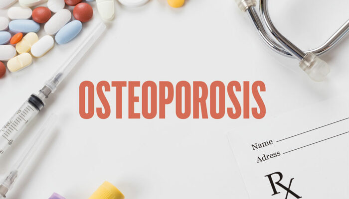 Things to Know About Osteoporosis Management