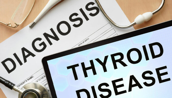 Thyroid Symptoms, Causes, Natural Remedies and Side Effects