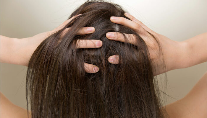 Top 5 Products to Combat Hair Loss