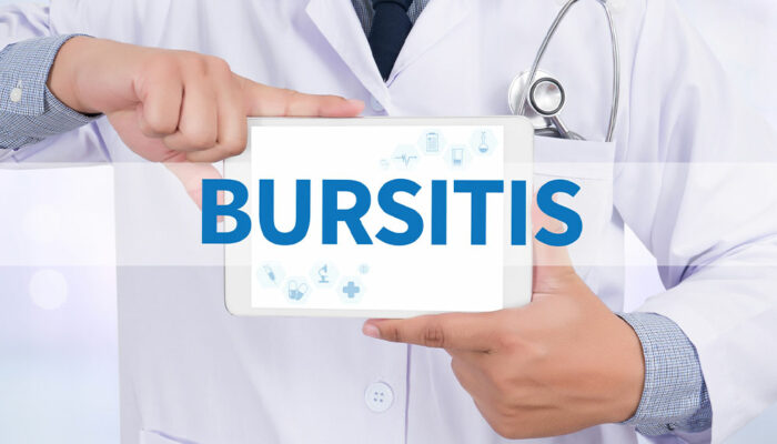 Types and Management Methods of Bursitis