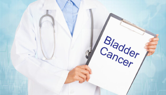 Understanding Bladder Cancer and Its Management Options