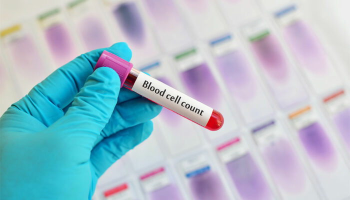 Understanding Different Aspects of Blood Cell Counts