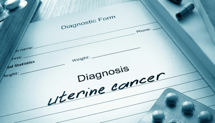 Uterine Cancer &#8211; Its Causes, Symptoms, and Stages