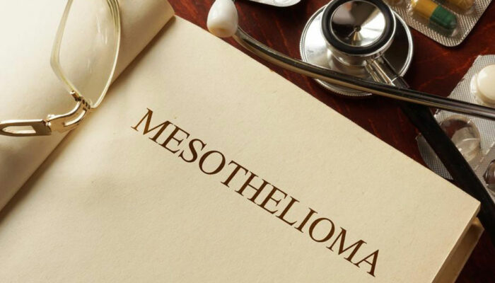 4 different types of mesothelioma you should be familiar with