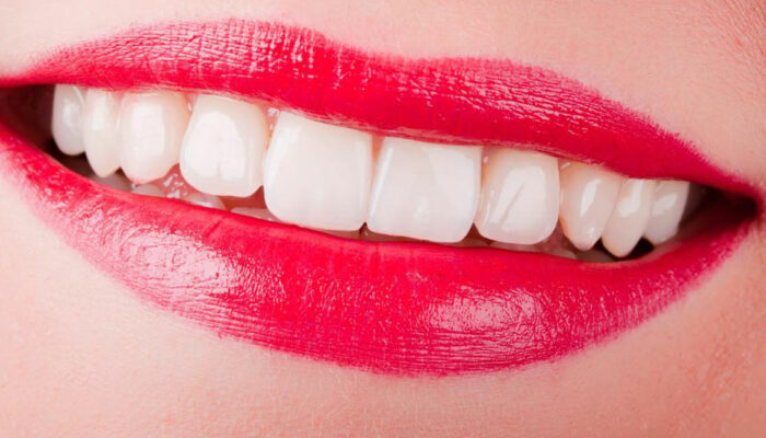 4 useful tips for sparkling pearly white teeth