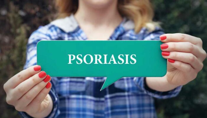 5 Ways to Treat Plaque Psoriasis at Home