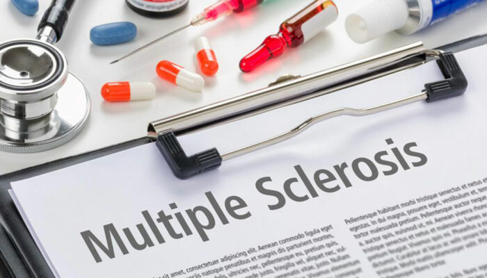 5 common symptoms of multiple sclerosis