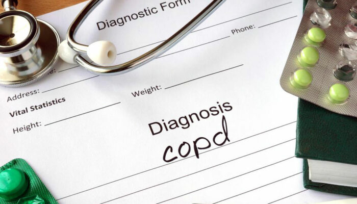 5 natural and alternative ways to treat COPD