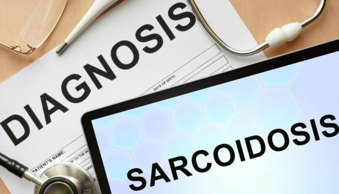 5 tell-tale signs and symptoms of sarcoidosis