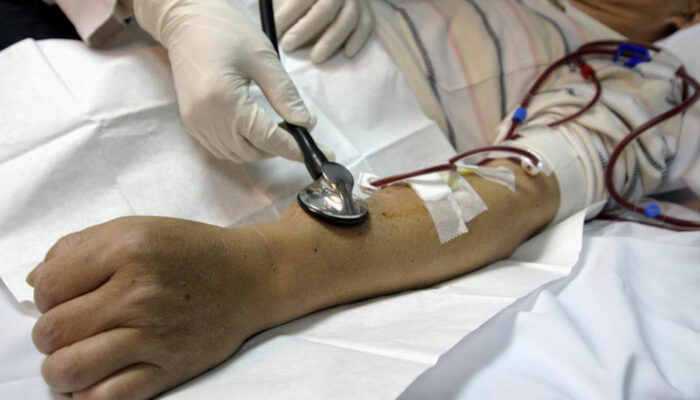 5 useful things a person undergoing kidney dialysis should know