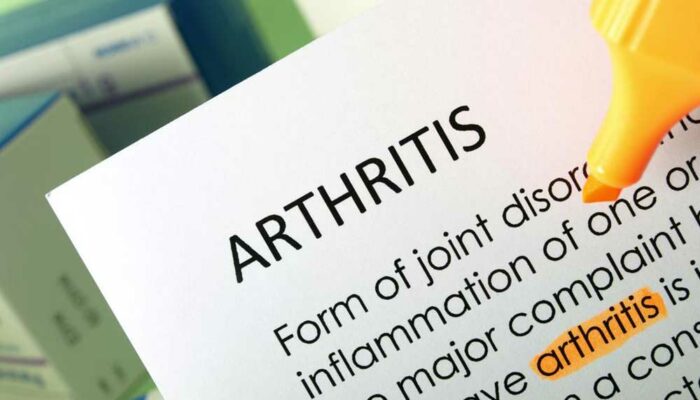 6 Effective Ways to Get Relief from Chronic Arthritis Pain Naturally