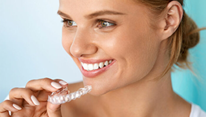 6 benefits of invisible aligners