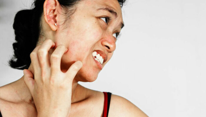 7 easy and useful ways to manage itchy skin