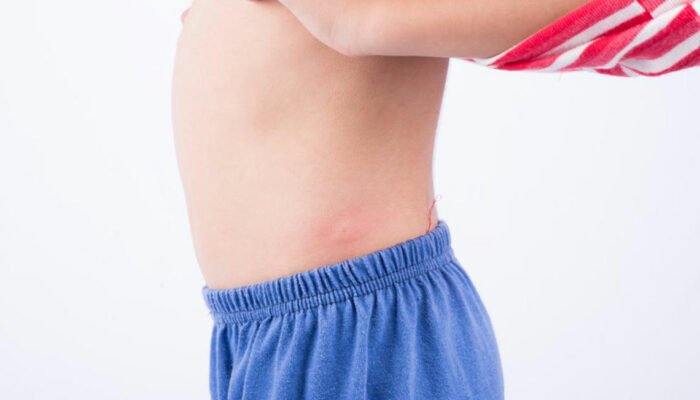 10 common types of skin rashes you should be aware of 