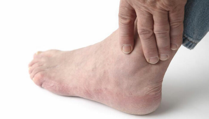 3 Daily habits to avoid foot pain