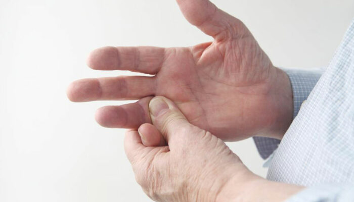 3 common causes of rheumatoid arthritis