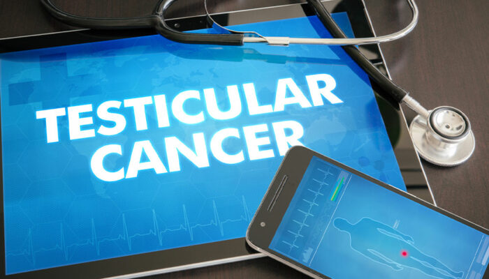 A Brief Overview of Testicular Cancer