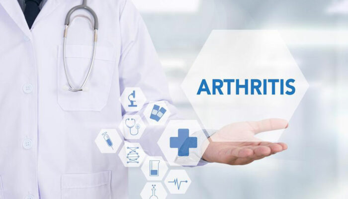 A brief overview of arthritis