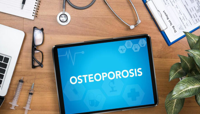 A brief overview of osteoporosis