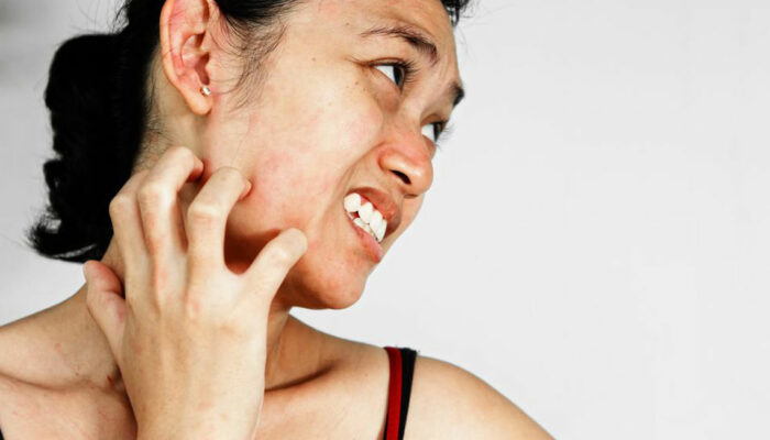 A few common types skin rash that affects people