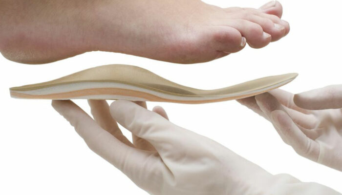 All you need to know about Orthotics