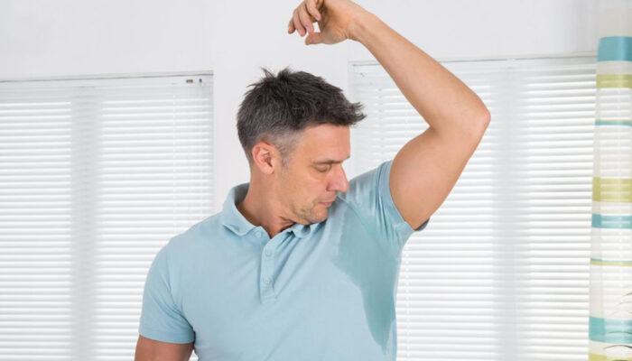 An overview of hyperhidrosis