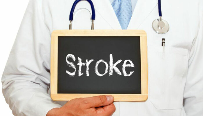 An overview of mini stroke- causes and symptoms explained