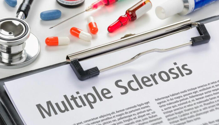 An overview of multiple sclerosis