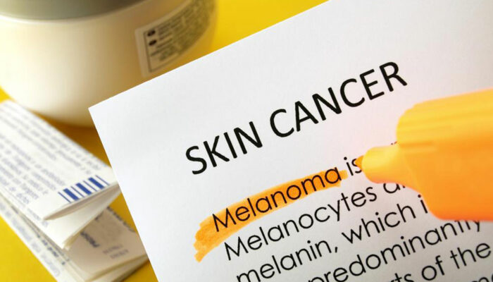 An overview of skin cancer