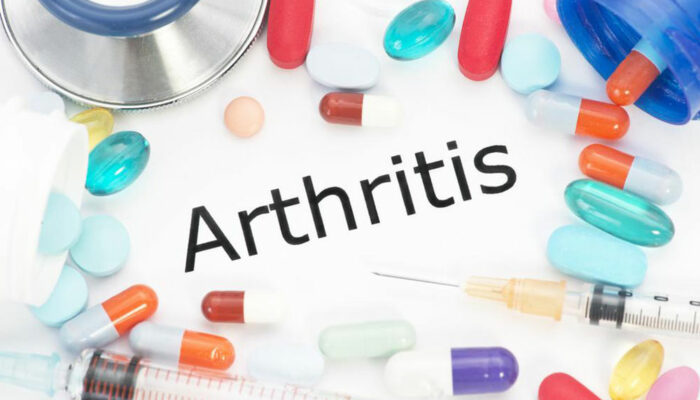 Arthritis &#8211; Classification and treatment