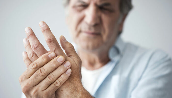 Arthritis &#8211; Types, signs and risk factors