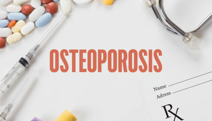 Bone density testing &#8211; An important diagnostic tool for osteoporosis