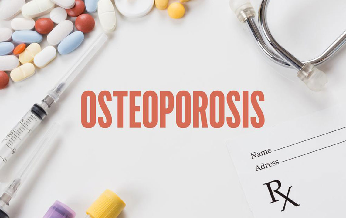 Bone density testing &#8211; An important diagnostic tool for osteoporosis