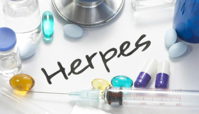 Causes and clinical symptoms of herpes