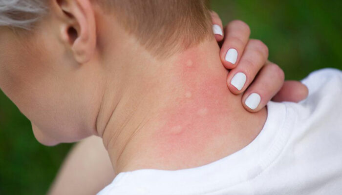 Causes and diagnosis of itchy skin